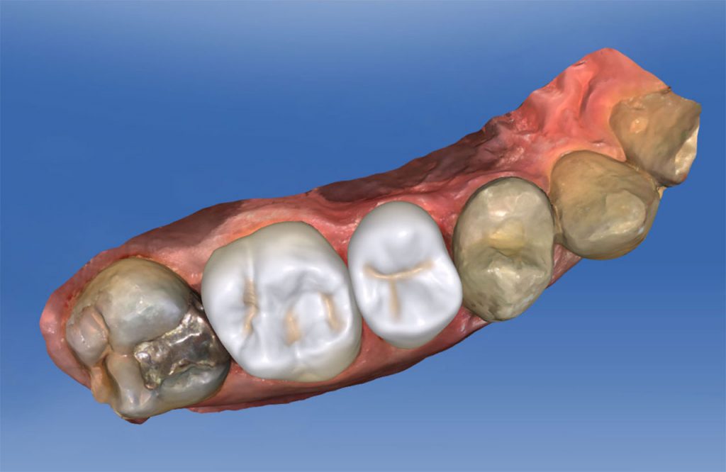 Odontoiatria Digitale