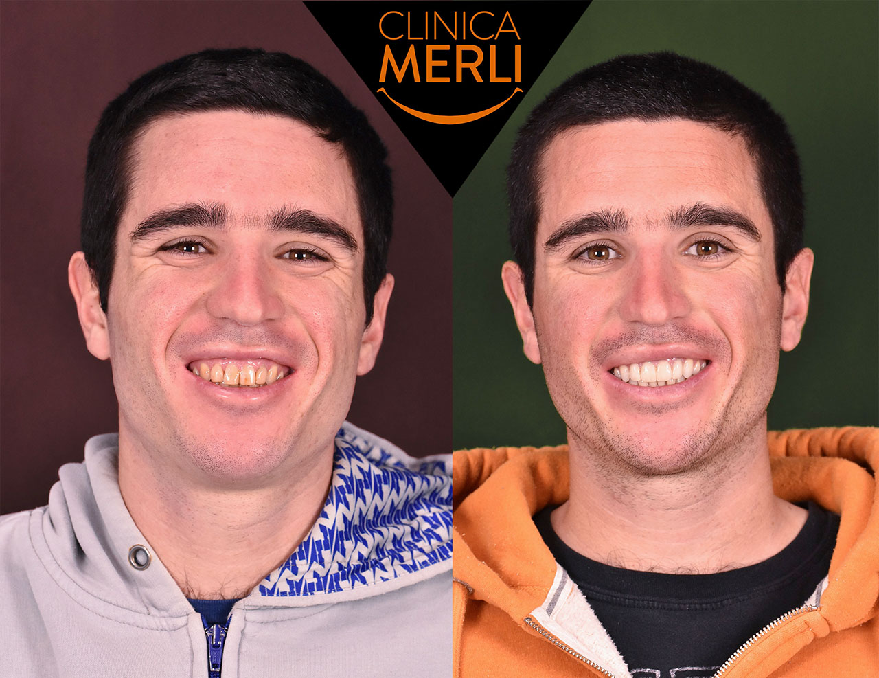 Pazienti felici e sorridenti Clinica Merli • Dentisti Rimini