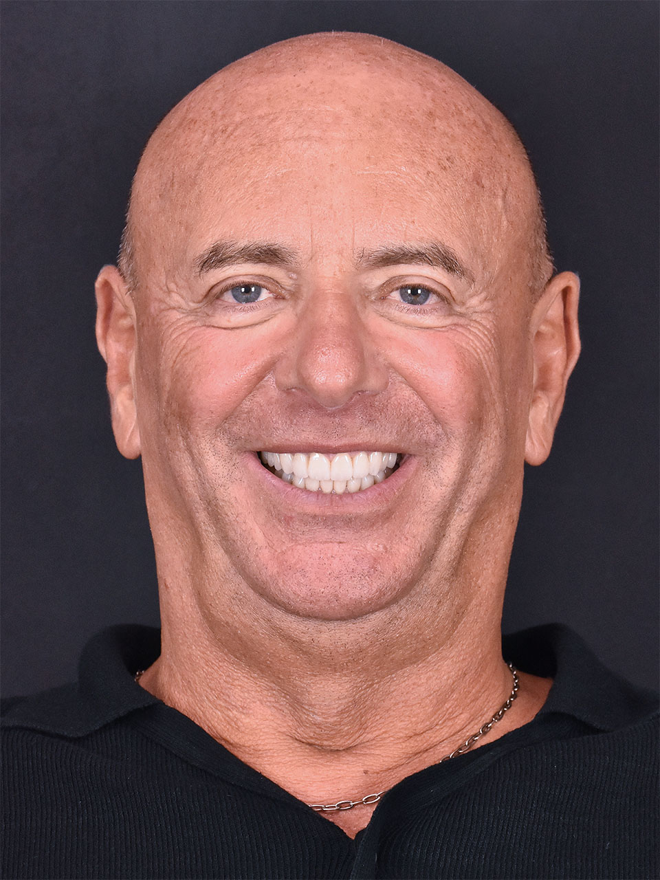 Dopo
